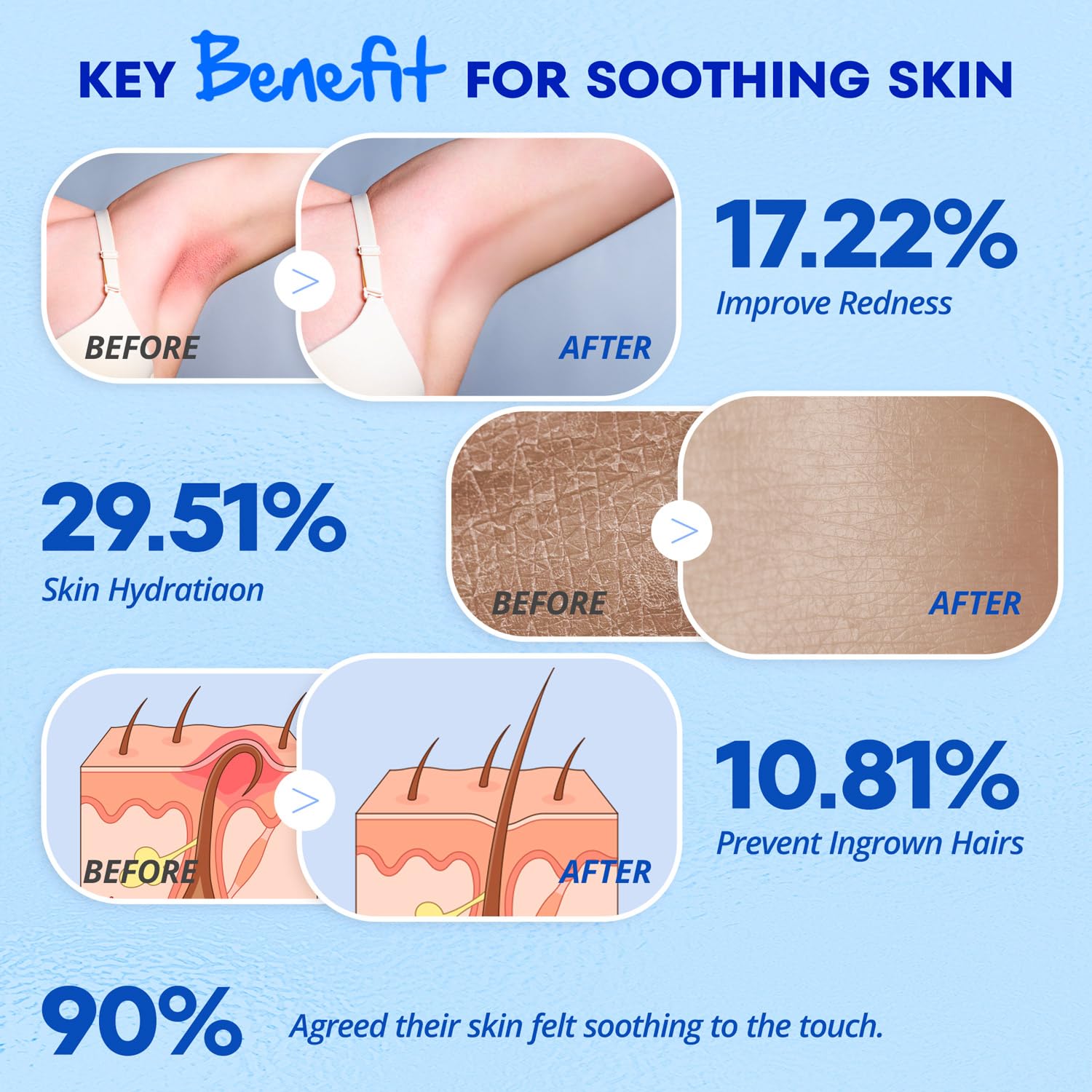 VG VOGCREST After Shave for Women: Post-Shave Soothing Serum for Face Legs Bikini Arms to Reduce Redness