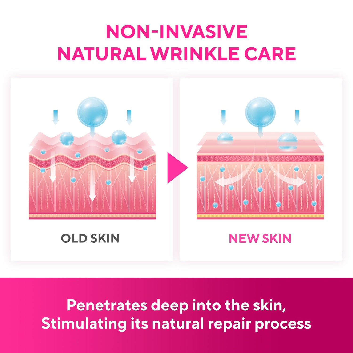 SILKDERMIS Silicone Face Patches 5pcs- Reusable Under Eye and Smile Line Patches Forehead fine line Patches 5pcs