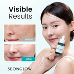 SEONGLOW 15% Vegan Niacinamide+ 3% Tranexamic Acid Serum: Korean Skin Care Niacinamide serum - Pore Minimizer for Face, Glutathione, Zinc PCA, 0.85 fl.oz.(25ml)