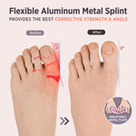 PEDIGOO Toe Spacer for Women 2pc, Non-Slip Toe Spacer, Hallux Valgus Relief for Day/Night Support (Beige)