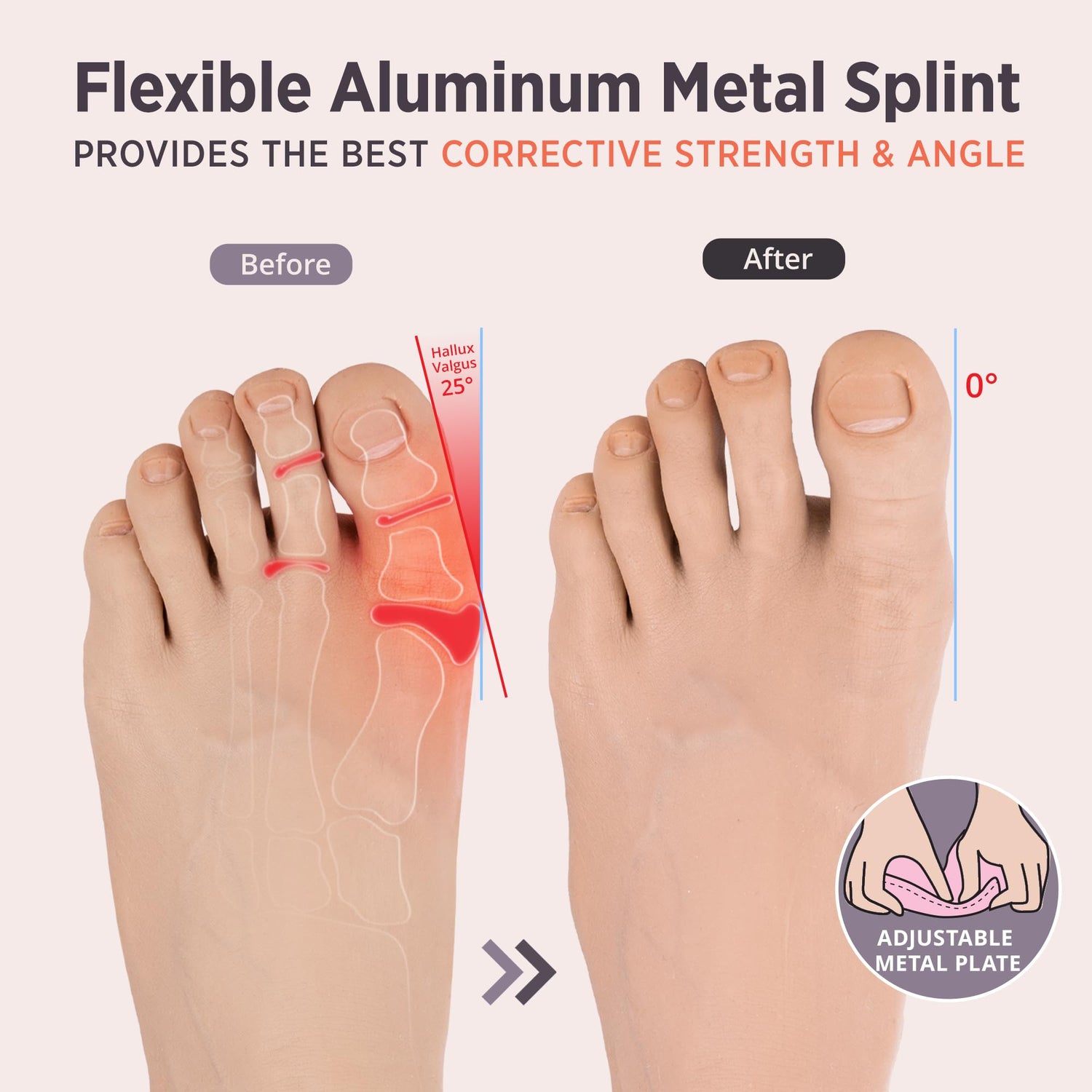 PEDIGOO Toe Spacer for Women 2pc, Non-Slip Toe Spacer, Hallux Valgus Relief for Day/Night Support (Beige)
