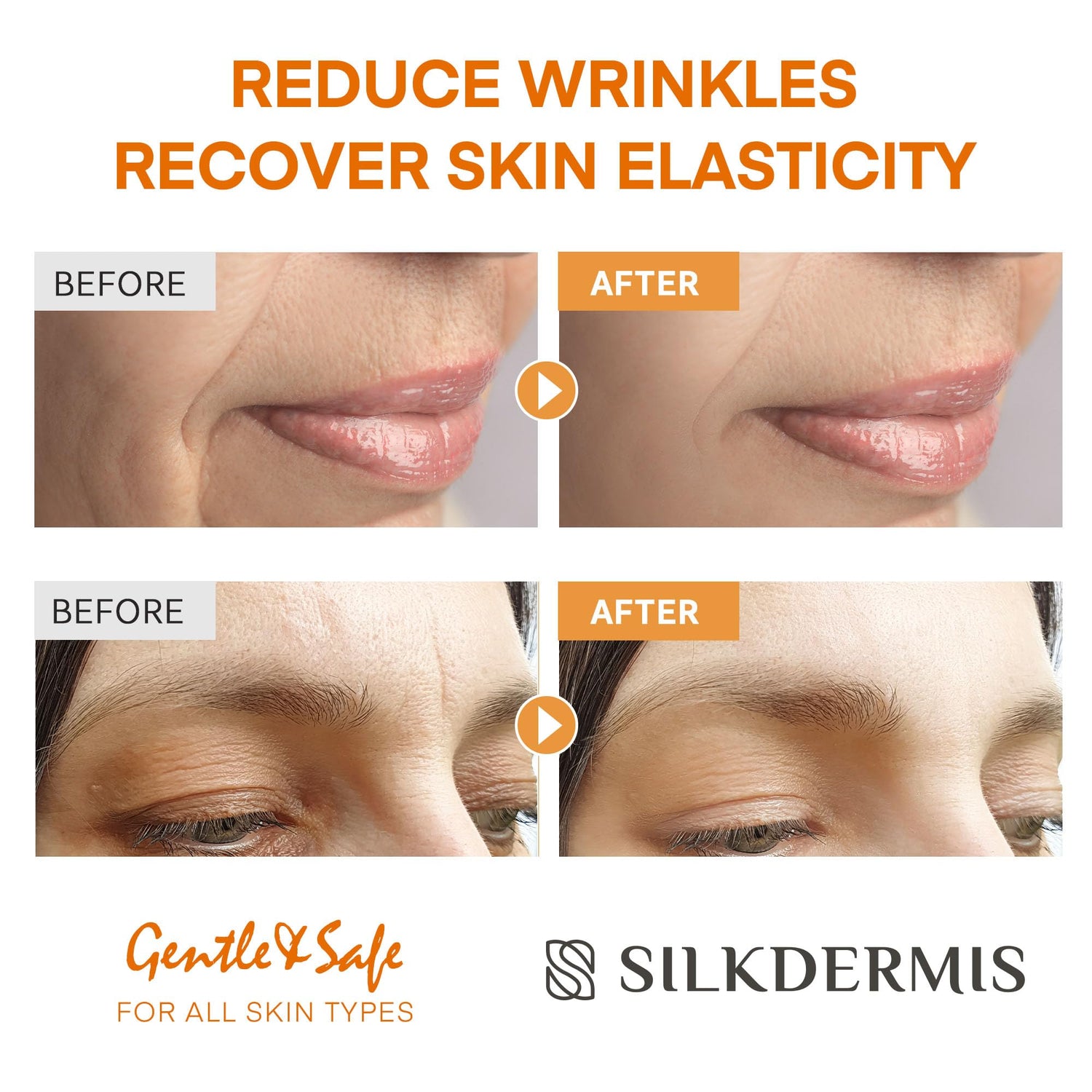 SILKDERMIS Forehead fine line Patches with Triangle: For Smile Line and Under-smoothing with Aloe, Collagen, Vitamin E 112pcs
